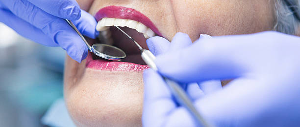 Best Emergency Dental Care for Broken or Chipped Teeth in Halsey, OR